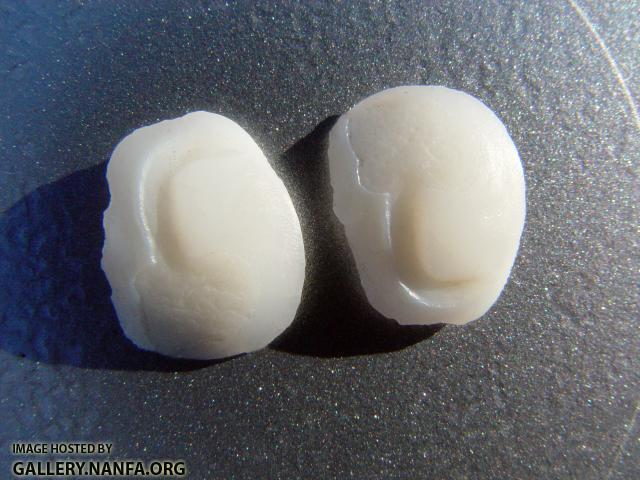 FRD Otolith04a